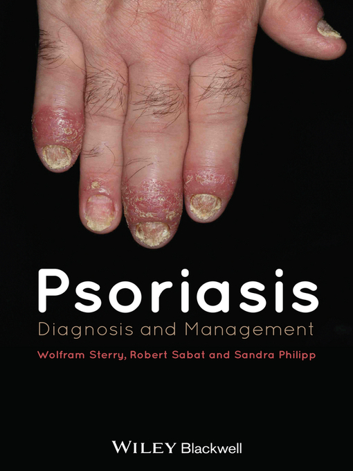 Title details for Psoriasis by Wolfram Sterry - Available
